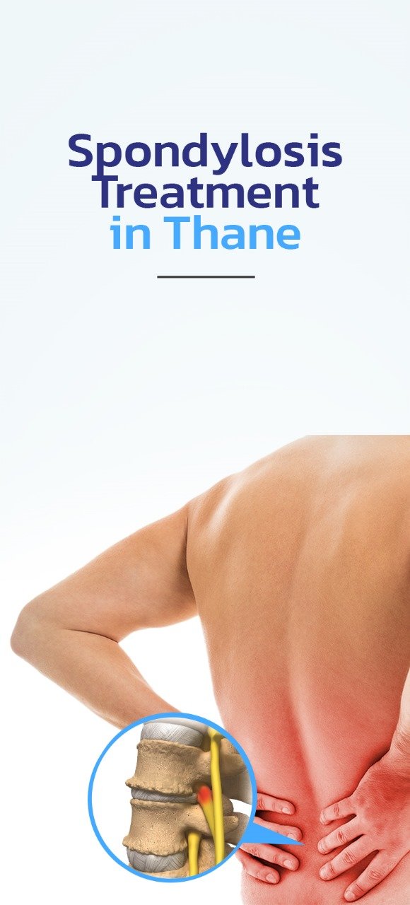 Spondylolisthesis Treatment in thane