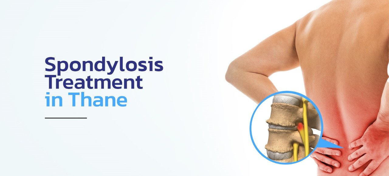 Spondylolisthesis Treatment in thane