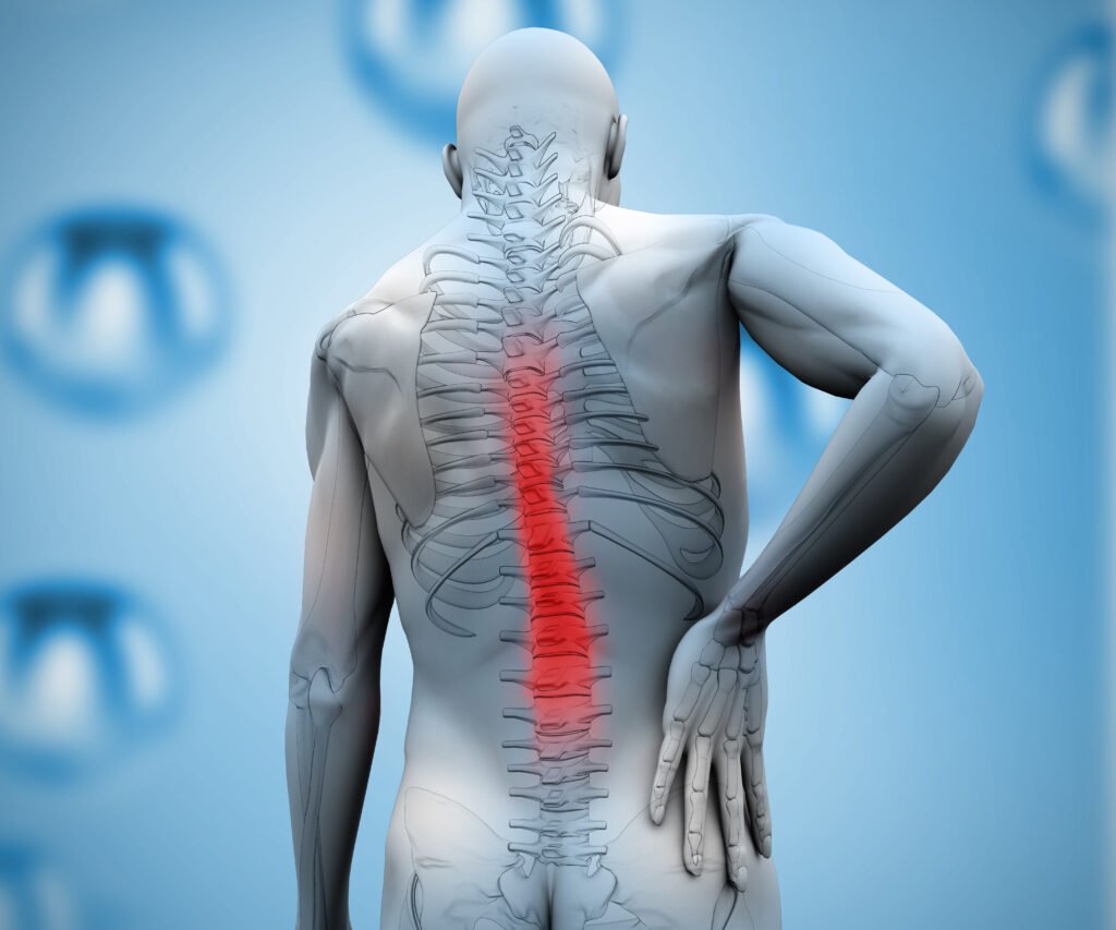 spondylolisthesis