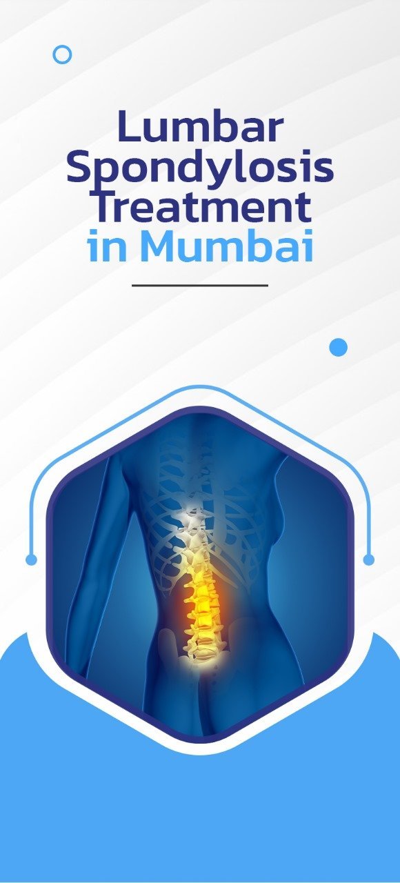 Lumbar Spondylosis Treatment in Mumbai
