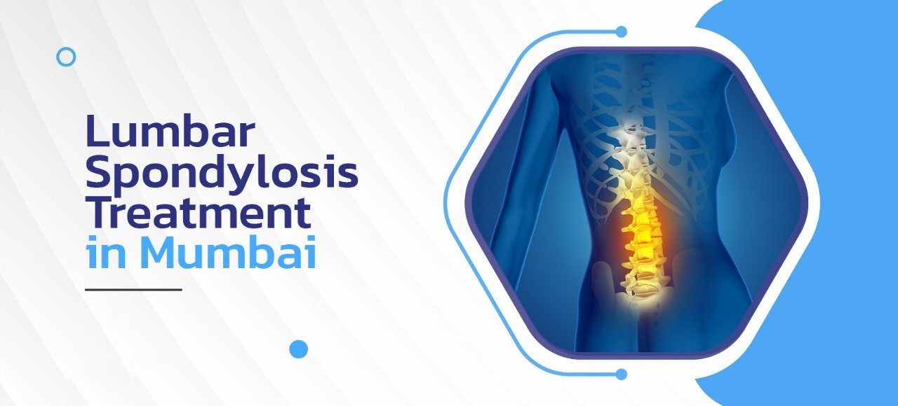 Lumbar Spondylosis Treatment in Mumbai