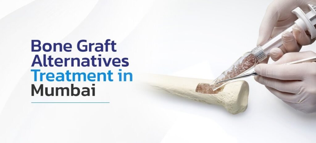 Bone Graft Alternatives Treatment in Mumbai