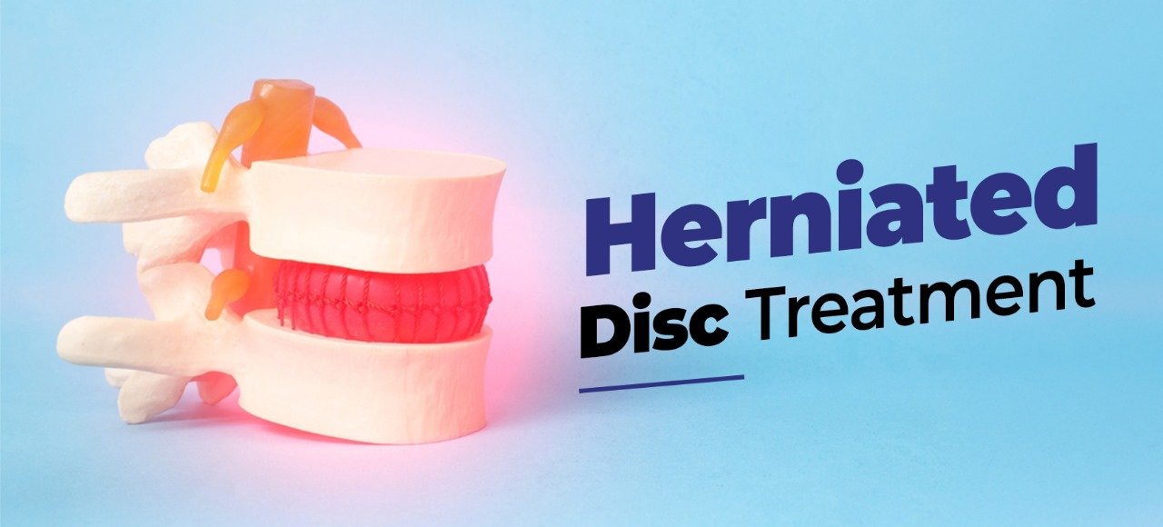 Herniated Discs